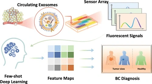 Exosome sensing and deep learning for breast cancer diagnosis
